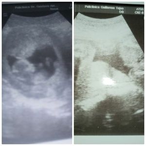 Meet your Posher, Zarate